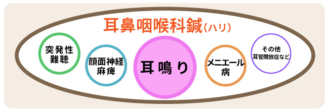 耳鳴りハリの図解